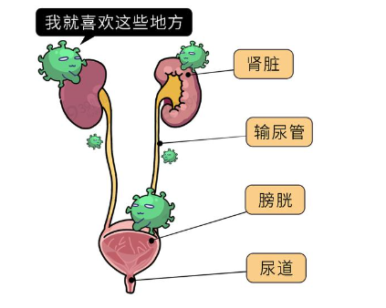 尿路感染反复发作的口服疫苗Uro-Vaxom的使用说明(图1)