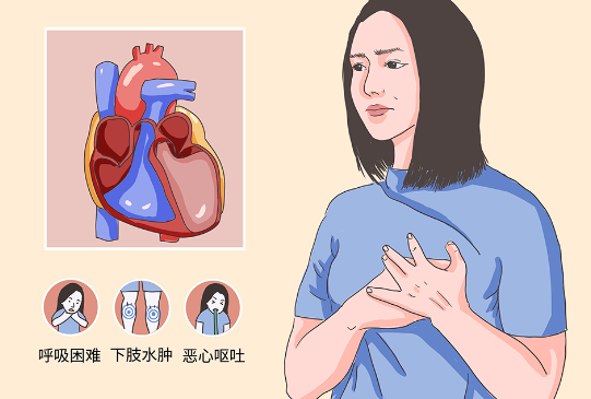 新药Inpefa有效降低心衰发生风险，降低了25.1%(图1)